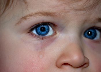 Occhi rossi nei bambini: cause e come rimediare