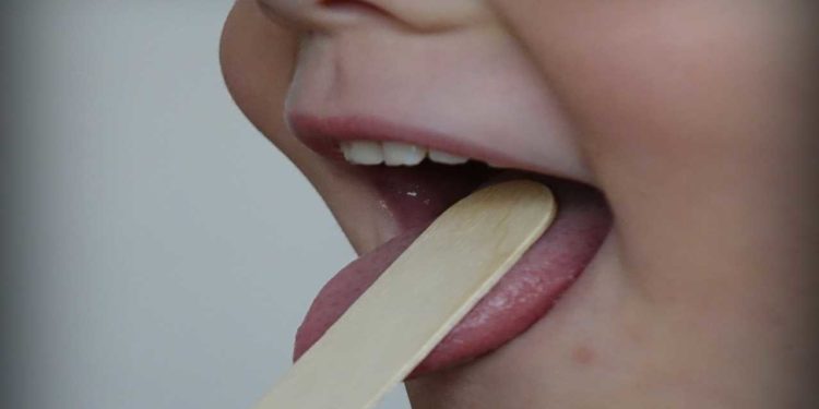 Faringotonsillite o mal di gola?